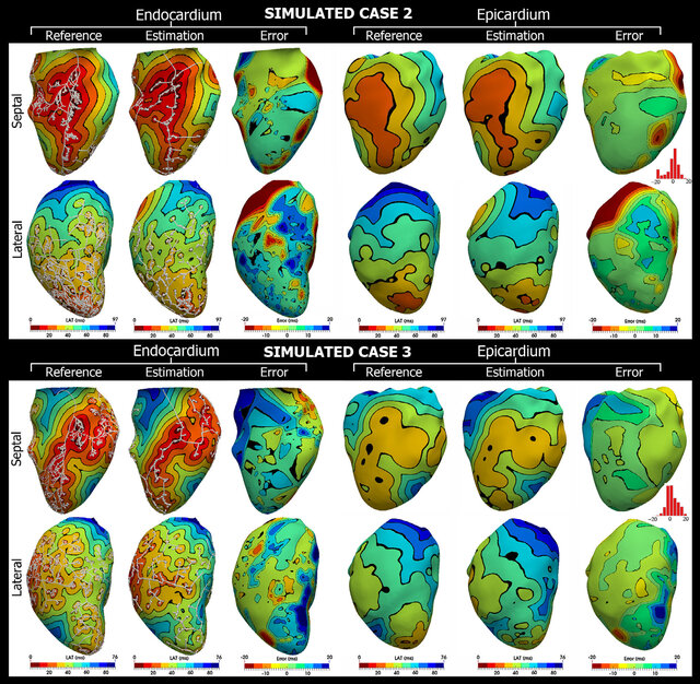 Estimated Purkinje myocardial junctions and Purkinje-Purkinje junctions from cardiac vascular modeling