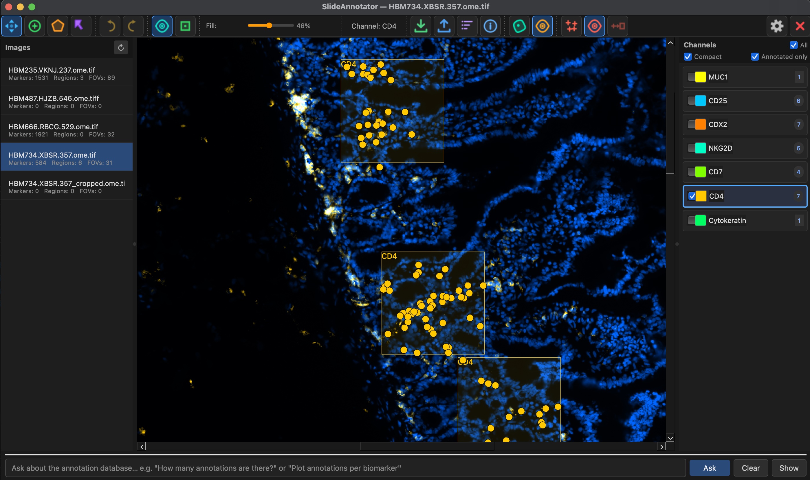 Slide annotation tool for microscopy and digital pathology image analysis