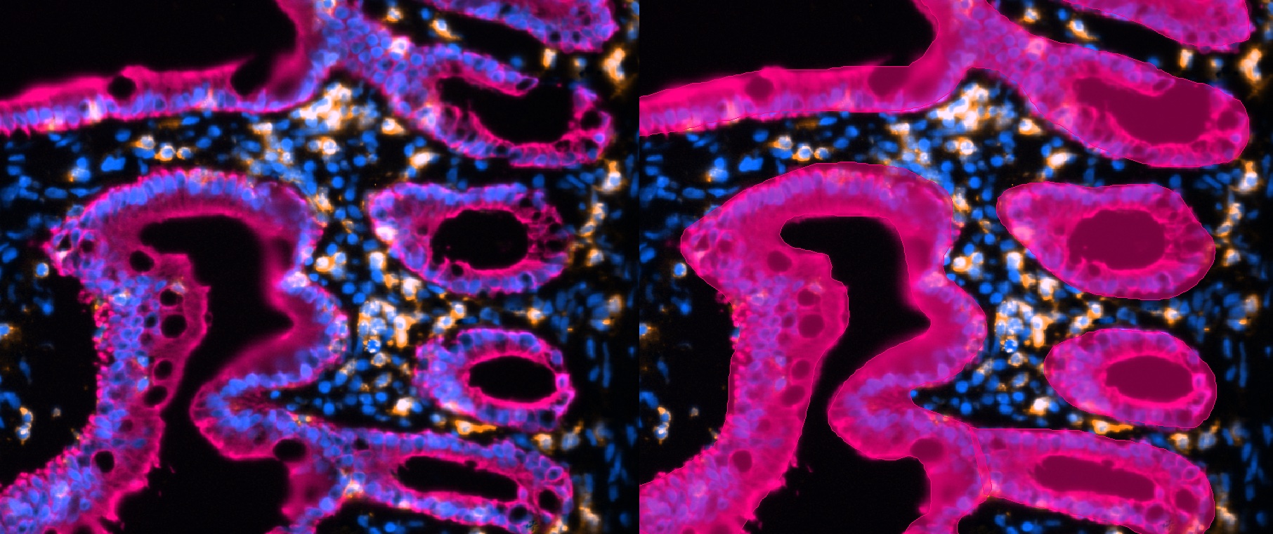 Multiplex immunofluorescence tissue image with cell segmentation overlay